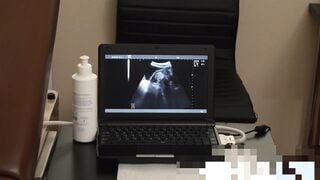 Therapist doctor secret threesome anal sex